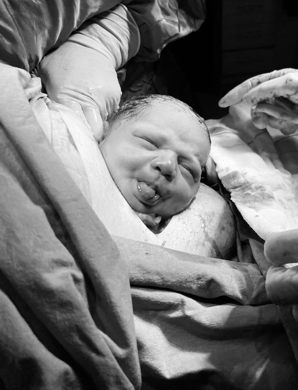 Advanced gynecological surgery close-up